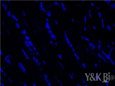 什么是Tunel