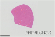 病理实验室│肝脏组织常见取材方向