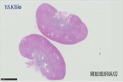病理实验│肾脏组织特殊染色及常见取材方向