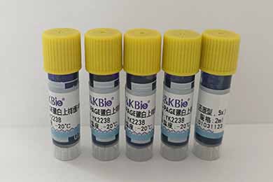 SDS-PAGE蛋白上样缓冲液（还原型，5x）