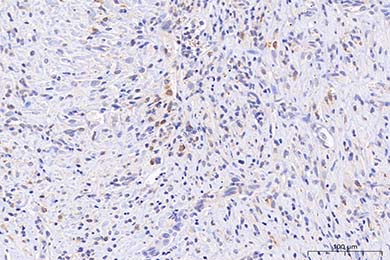 Anti-iNOS Antibody
