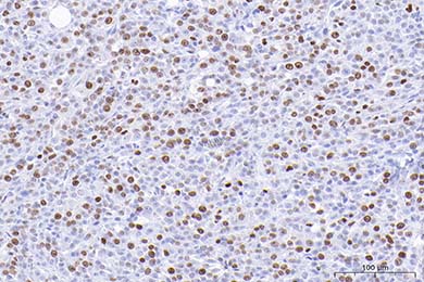Anti-Ki67 Antibody [SR00-02]