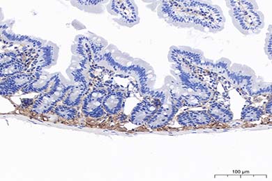 Anti-MMP-2 Antibody [PSH11-26]