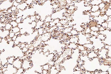 NF-kB p65 Recombinant Rabbit Monoclonal Antibody [SZ10-04]