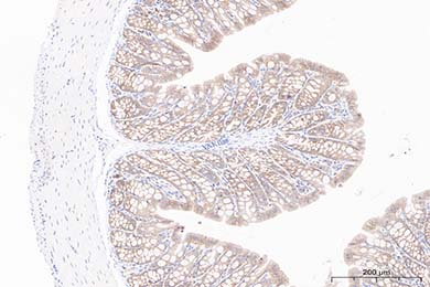 Occludin Recombinant Rabbit Monoclonal Antibody [JJ091-08]