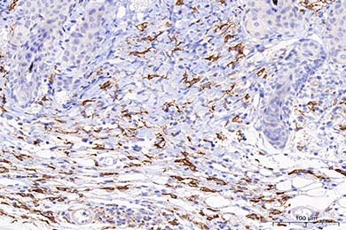 Mannose Receptor(CD206) Recombinant Rabbit Monoclonal Antibody [PSH07-76]