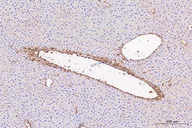 Anti-alpha smooth muscle Actin Antibody [SY02-64]
